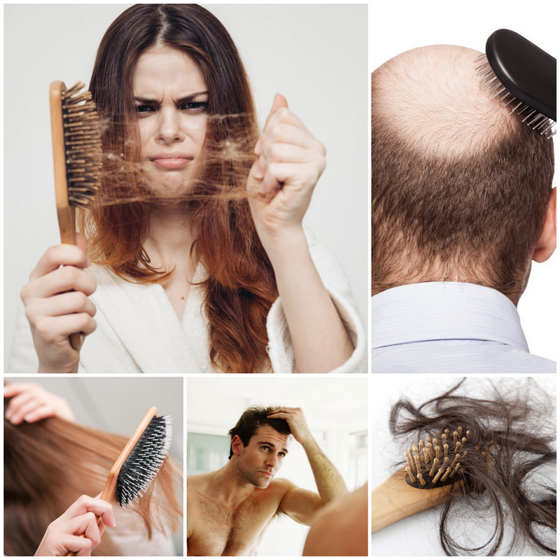 Выпадение волос причины и лечение - просто о серьёзной проблеме