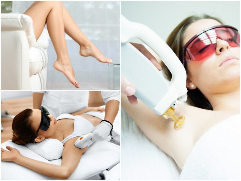 Лазерное удаление волос - готовимся к процедуре